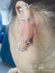 打了耳洞可以吃瓜吗,打耳洞后，美味瓜果随心享